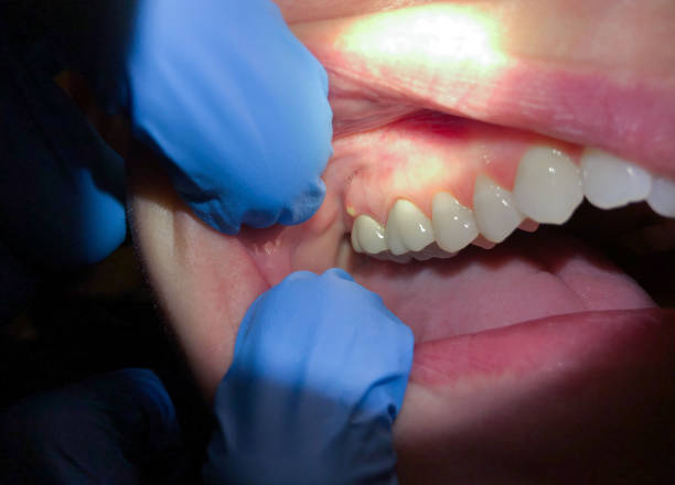 Best Pediatric Emergency Dentist in Potomac Heights, MD